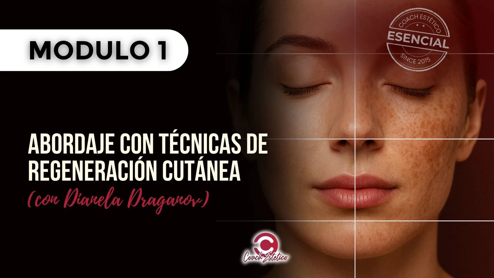 Módulo 01 — Abordaje con Técnicas de Regeneración Cutánea